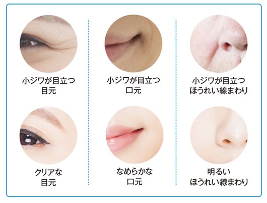 �G�e���m���e�t